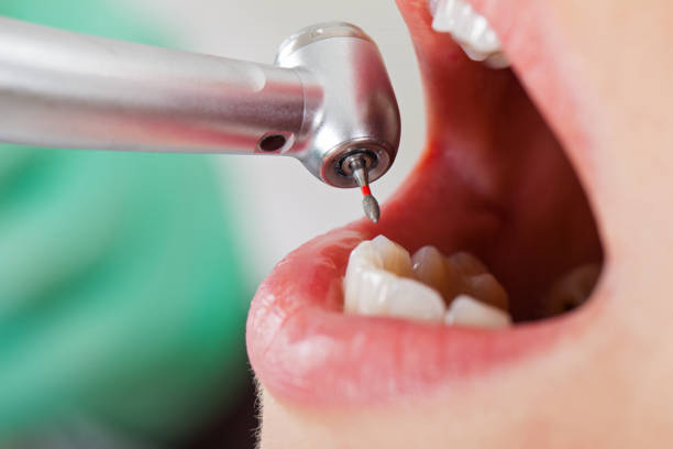 Best Walk-In Emergency Dentist in Fern Prairie, WA